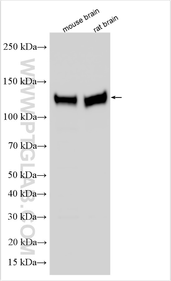 Western Blot (WB) analysis of various lysates using NRCAM Polyclonal antibody (21608-1-AP)