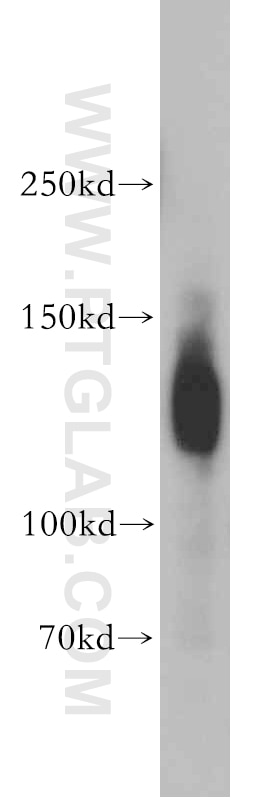 Western Blot (WB) analysis of human brain tissue using NRCAM Polyclonal antibody (21608-1-AP)