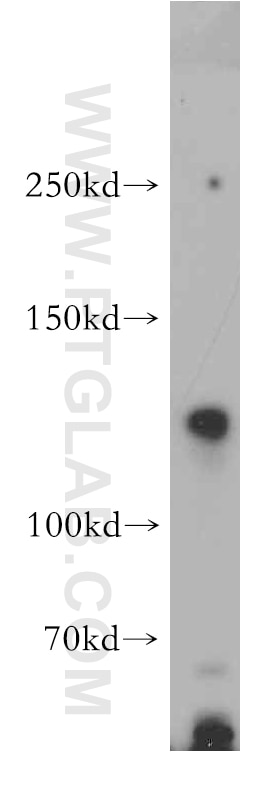 Western Blot (WB) analysis of HEK-293 cells using NRCAM Polyclonal antibody (21608-1-AP)