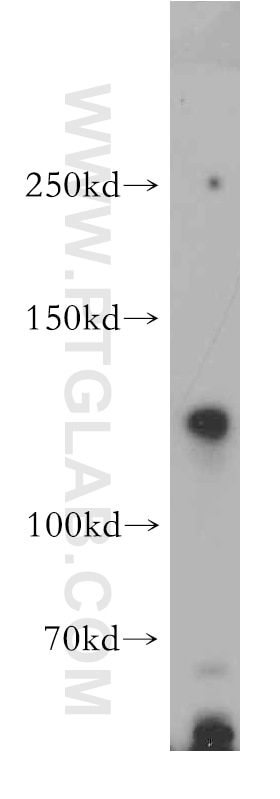 WB analysis of HEK-293 using 21608-1-AP