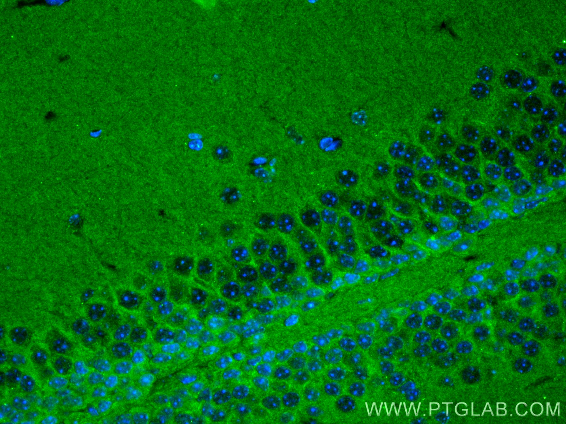 Immunofluorescence (IF) / fluorescent staining of mouse brain tissue using NRCAM Monoclonal antibody (68291-1-Ig)