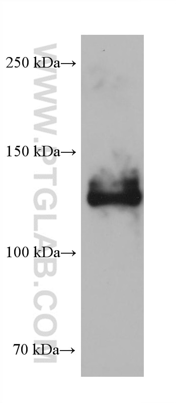 Western Blot (WB) analysis of rat cerebellum tissue using NRCAM Monoclonal antibody (68291-1-Ig)