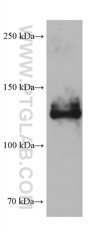 WB analysis of rat cerebellum using 68291-1-Ig