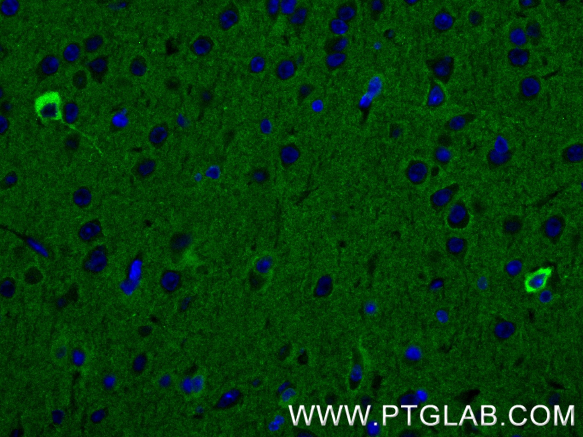 Immunofluorescent analysis of (4% PFA) fixed paraffin-embedded mouse brain tissue using NRCAM antibody (84690-1-RR, Clone: 241862G1 ) at dilution of 1:200 and CoraLite®488-Conjugated Goat Anti-Rabbit IgG(H+L) (SA00013-2). Heat mediated antigen retrieval with Tris-EDTA buffer (pH 9.0). This data was developed using the same antibody clone with 84690-1-PBS in a different storage buffer formulation. Immunofluorescence (IF) / fluorescent staining of mouse brain tissue using NRCAM Recombinant monoclonal antibody (84690-1-RR)
