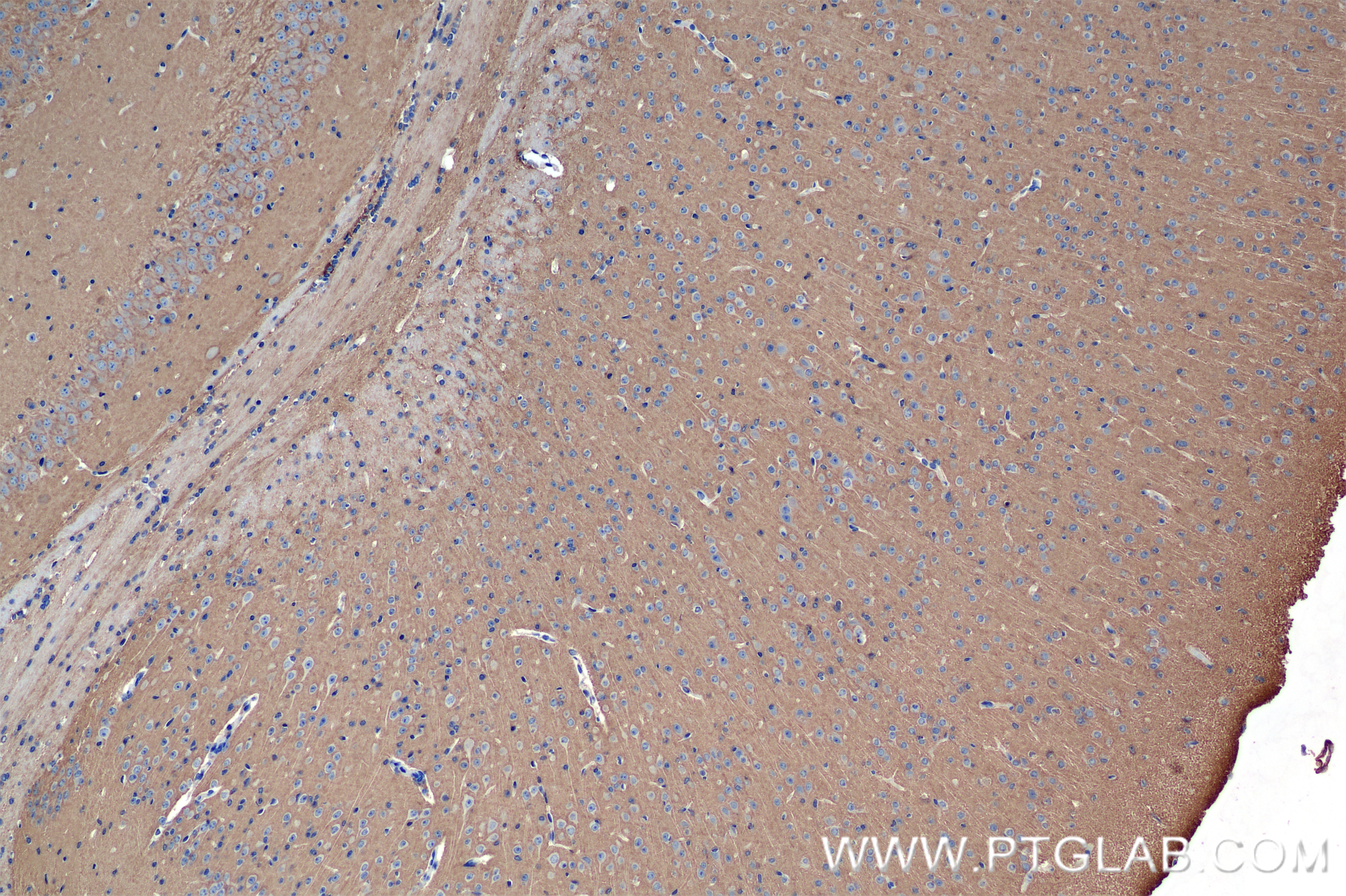Immunohistochemistry (IHC) staining of mouse brain tissue using NRCAM Recombinant antibody (84690-1-RR)