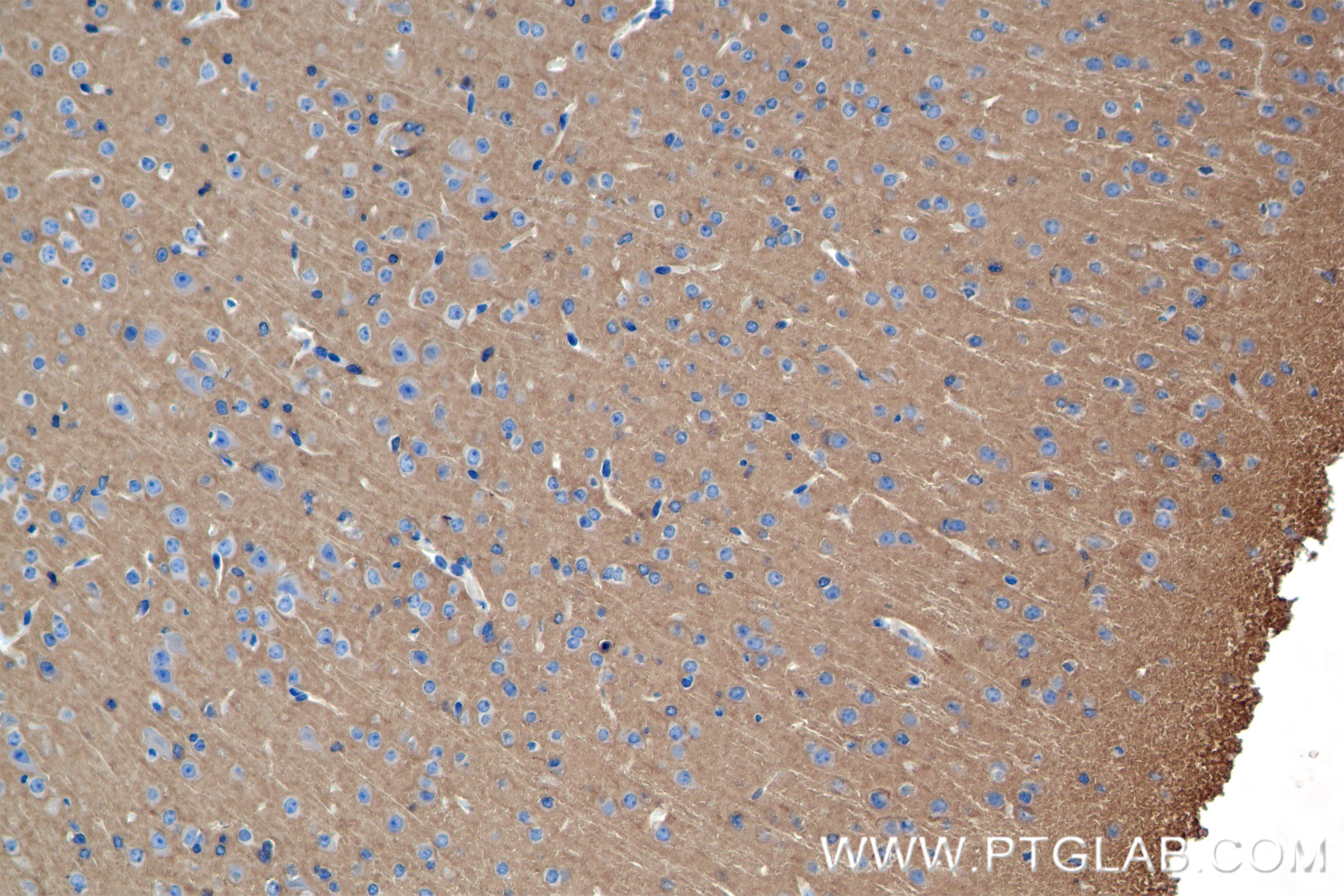 Immunohistochemistry (IHC) staining of mouse brain tissue using NRCAM Recombinant antibody (84690-1-RR)