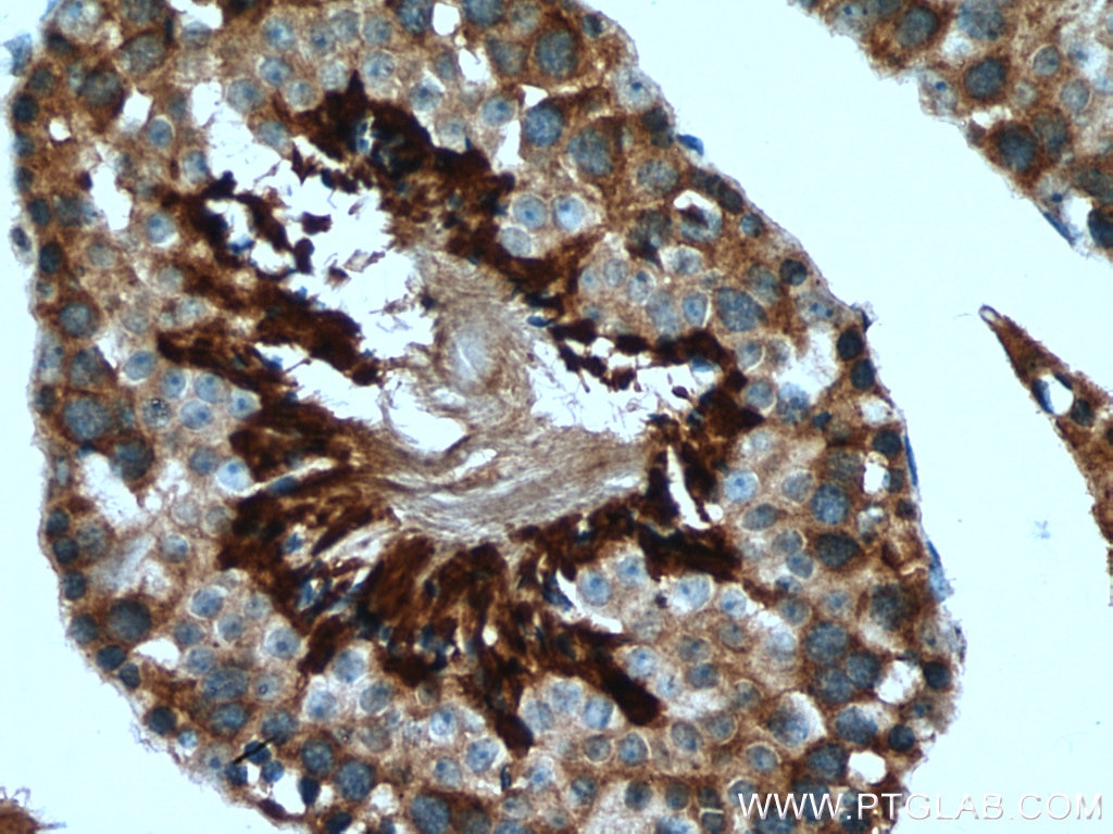 Immunohistochemistry (IHC) staining of mouse testis tissue using NRD1 Polyclonal antibody (15630-1-AP)
