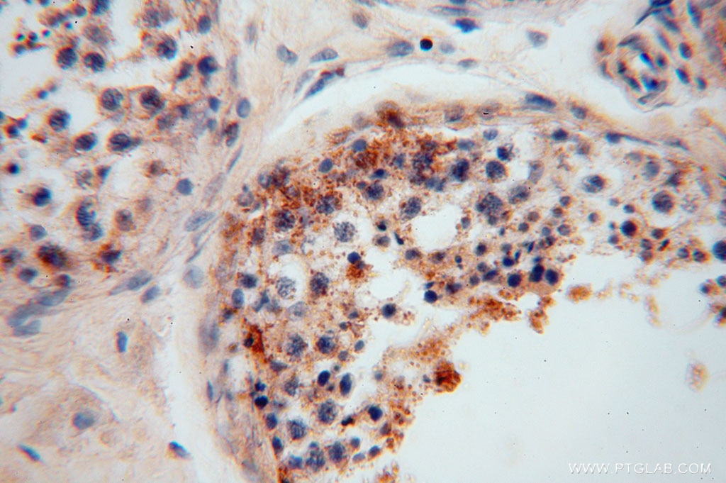 Immunohistochemistry (IHC) staining of human testis tissue using NRD1 Polyclonal antibody (15630-1-AP)