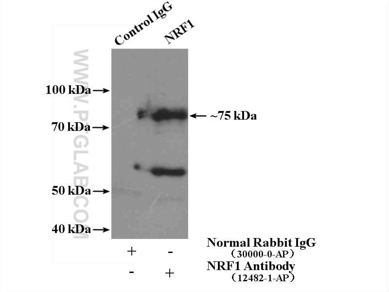 Immunoprecipitation (IP) experiment of mouse skeletal muscle tissue using NRF1/nuclear respiratory factor 1 Polyclonal antib (12482-1-AP)