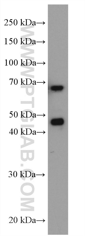 Western Blot (WB) analysis of A431 cells using NRF1/nuclear respiratory factor 1 Polyclonal antib (12482-1-AP)