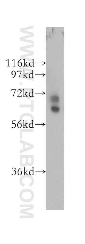 Western Blot (WB) analysis of human lung tissue using NRF1/nuclear respiratory factor 1 Polyclonal antib (12482-1-AP)