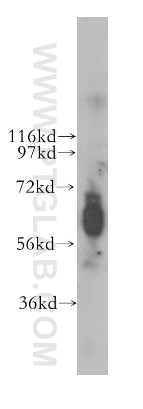 NRF1/nuclear respiratory factor 1 Polyclonal antibody