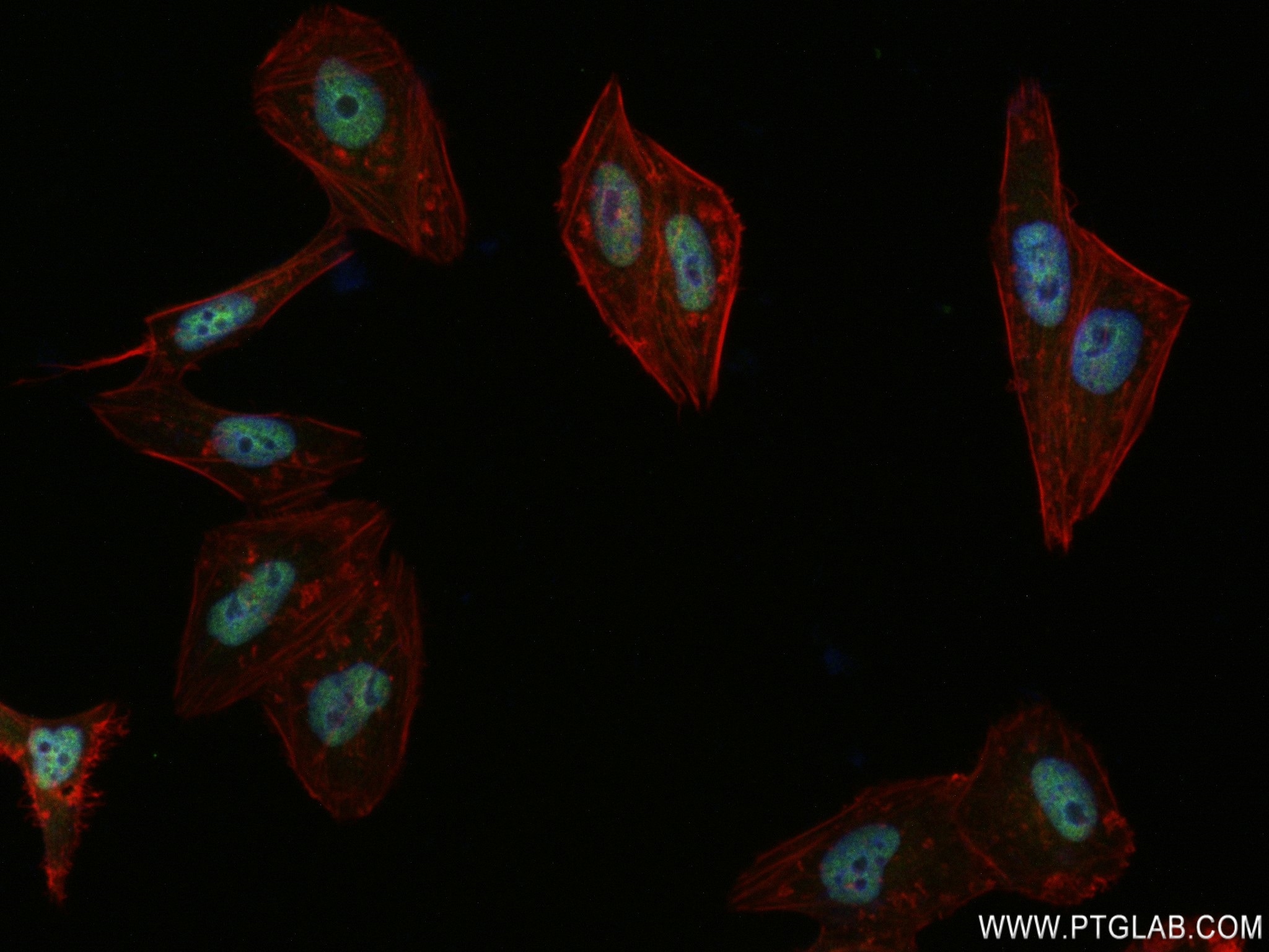 IF Staining of HepG2 using 83092-1-RR