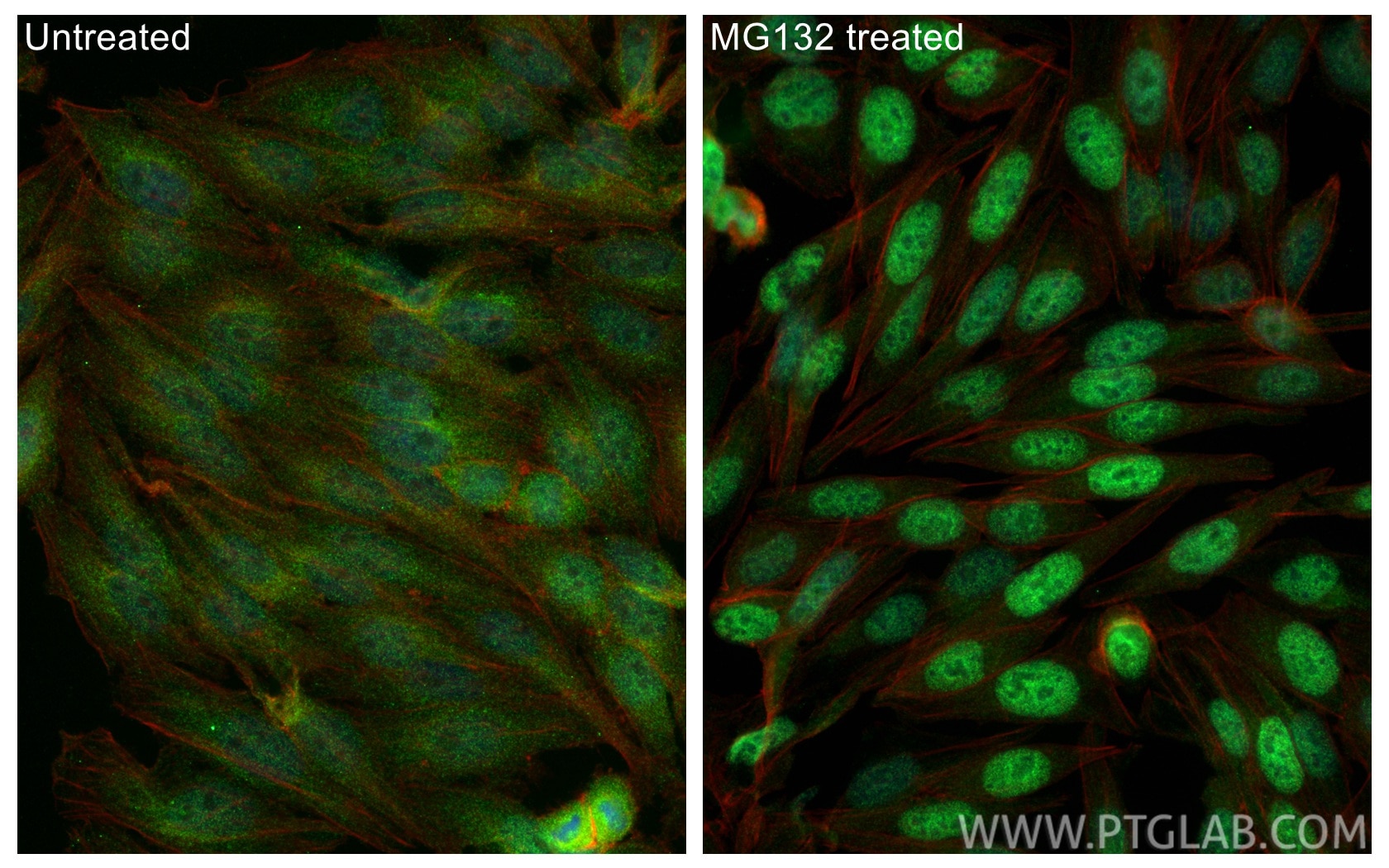 IF Staining of HepG2 using 66504-1-Ig Immunofluorescence (IF) / fluorescent staining of HepG2 cells using NRF2/NFE2L2 Monoclonal antibody (66504-1-Ig)