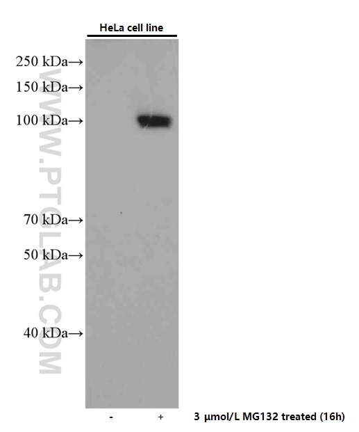 WB analysis of HeLa using 66504-1-Ig