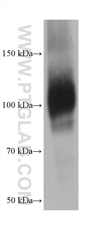MG132 treated NIH/3T3 cells were subjected to SDS PAGE followed by western blot with 66504-1-Ig (NRF2, NFE2L2 antibody) at dilution of 1:10000 incubated at room temperature for 1.5 hours. Western Blot (WB) analysis of NIH/3T3 cells using NRF2, NFE2L2 Monoclonal antibody (66504-1-Ig)