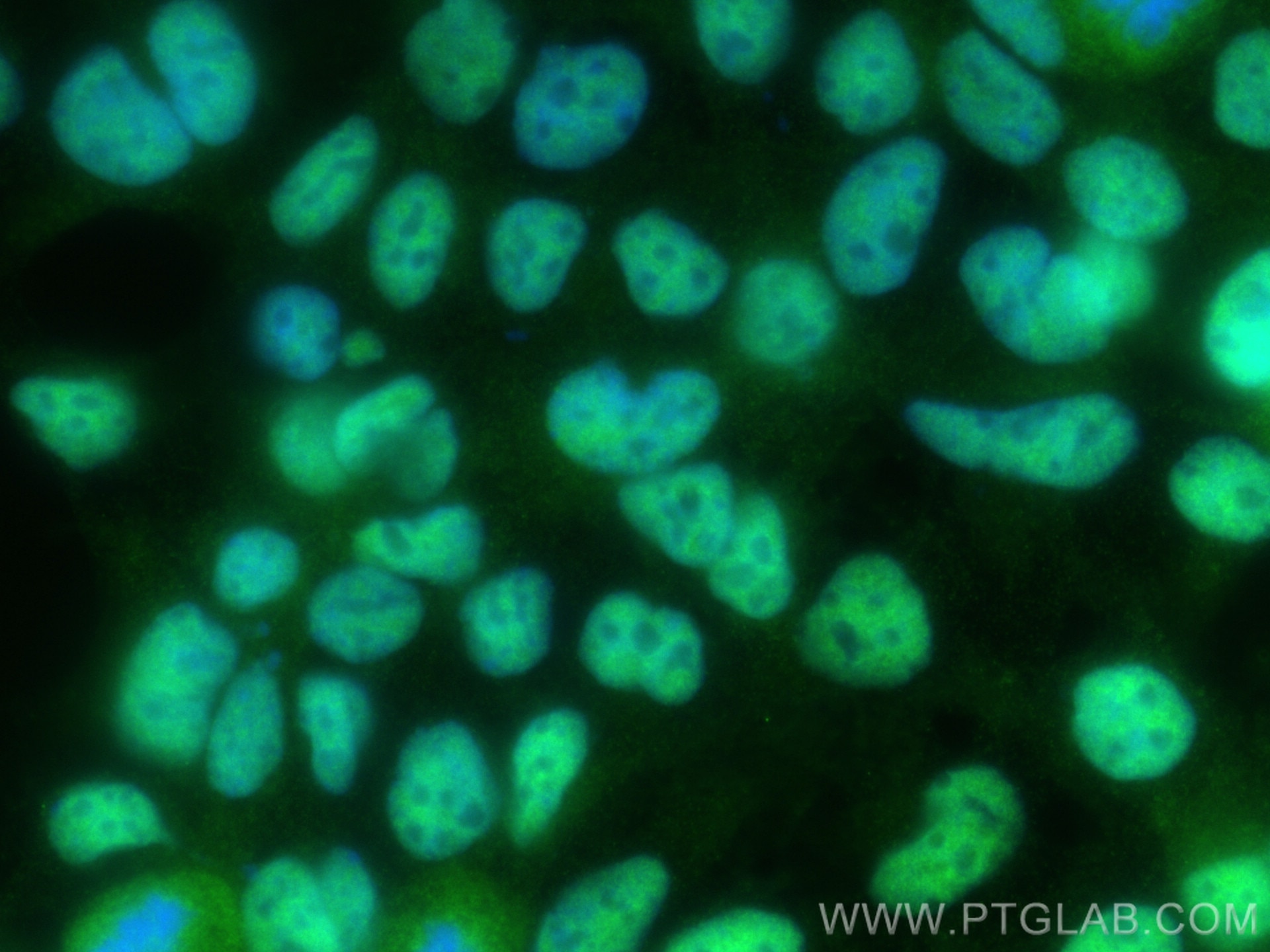 Immunofluorescence (IF) / fluorescent staining of HEK-293 cells using GABPA Polyclonal antibody (21542-1-AP)