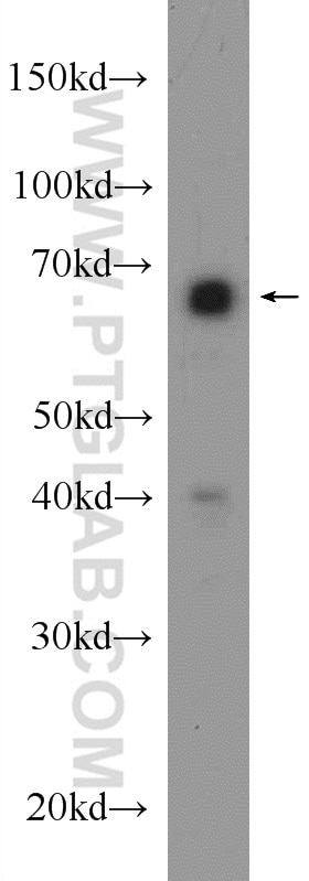 Western Blot (WB) analysis of mouse liver tissue using GABPA Polyclonal antibody (21542-1-AP)