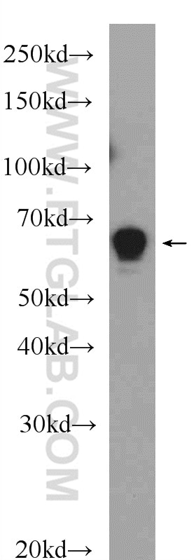 Western Blot (WB) analysis of rat brain tissue using GABPA Polyclonal antibody (21542-1-AP)