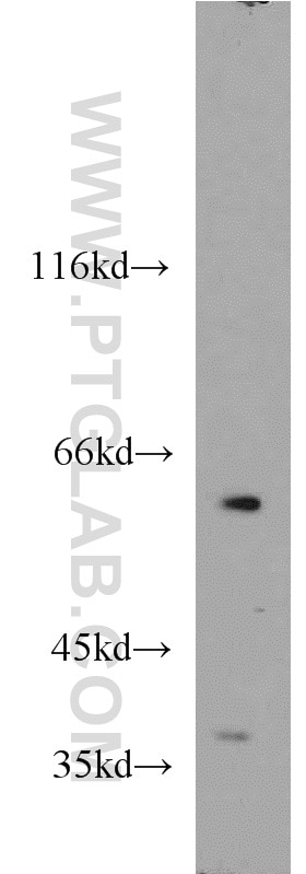 Western Blot (WB) analysis of MCF-7 cells using GABPA Polyclonal antibody (21542-1-AP)