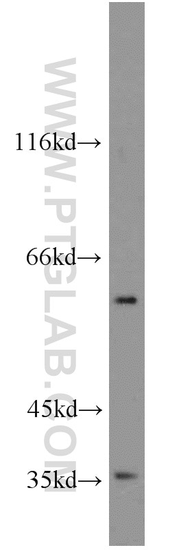 Western Blot (WB) analysis of A431 cells using GABPA Polyclonal antibody (21542-1-AP)