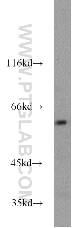 Western Blot (WB) analysis of A549 cells using GABPA Polyclonal antibody (21542-1-AP)
