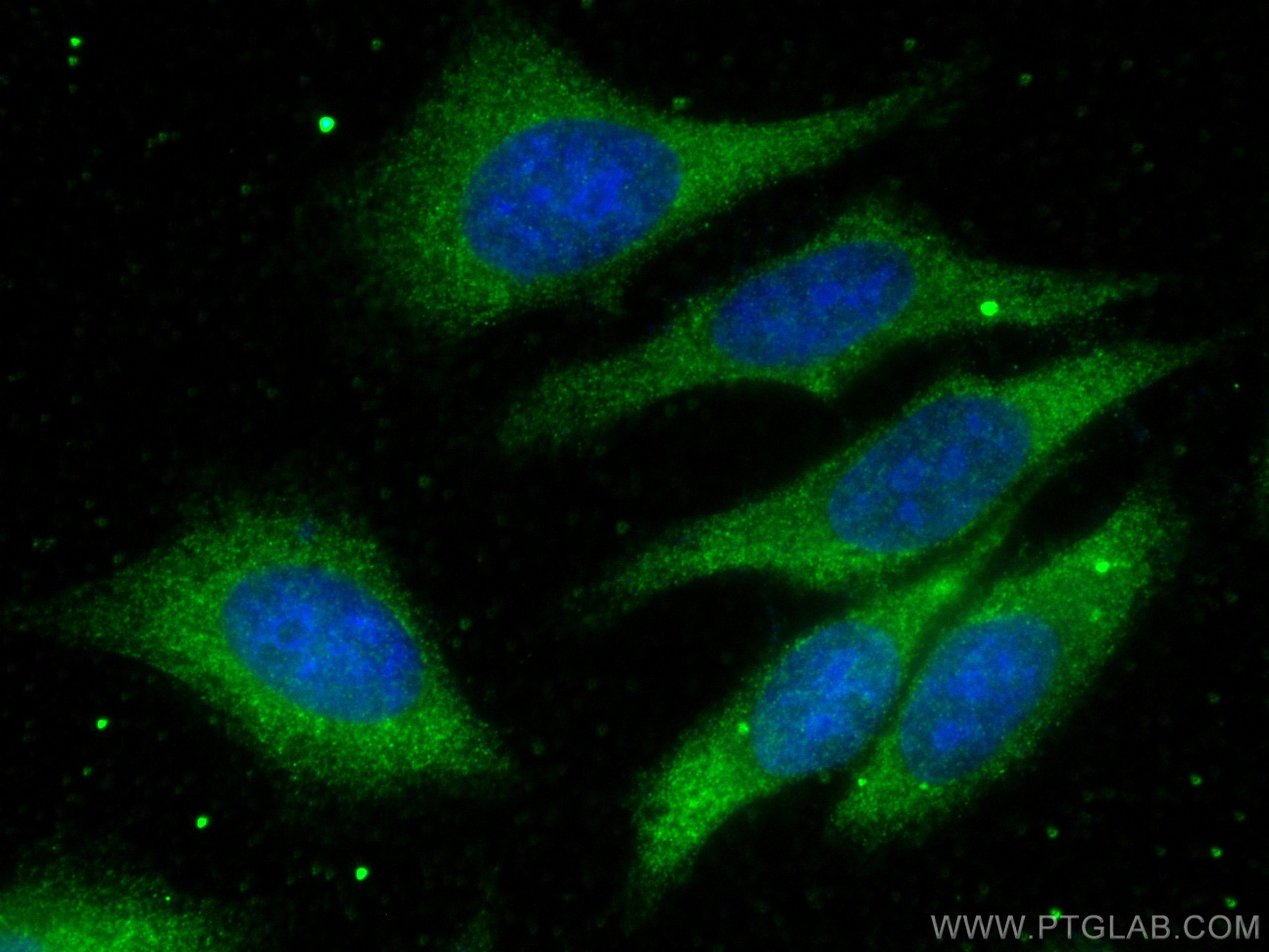 Immunofluorescence (IF) / fluorescent staining of HepG2 cells using NRF2, NFE2L2 Recombinant antibody (80593-1-RR)