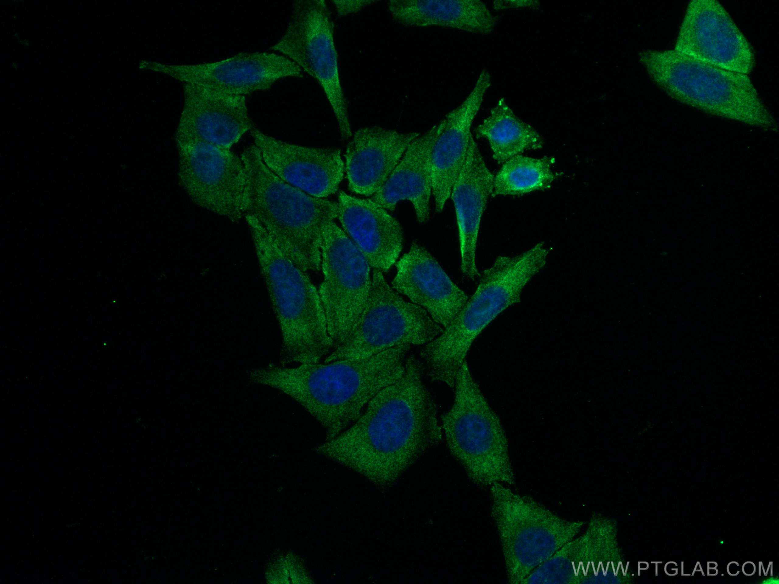 Immunofluorescence (IF) / fluorescent staining of HepG2 cells using NRF2, NFE2L2 Recombinant antibody (80593-1-RR)