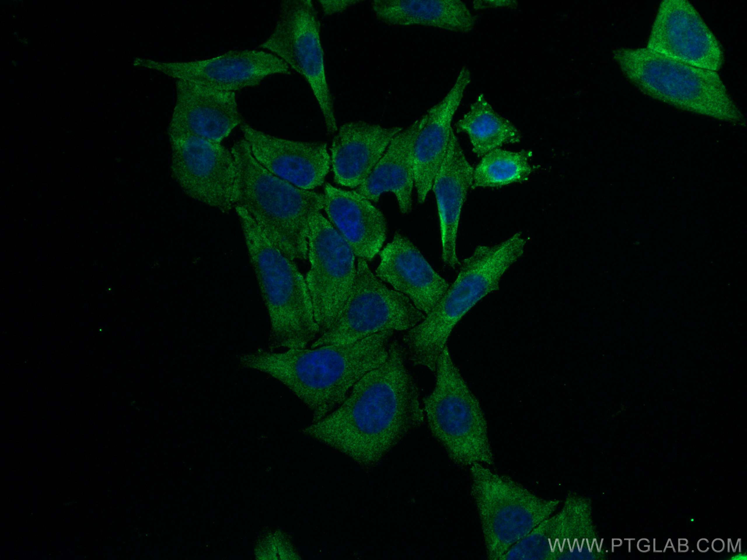 IF Staining of HepG2 using 80593-1-RR