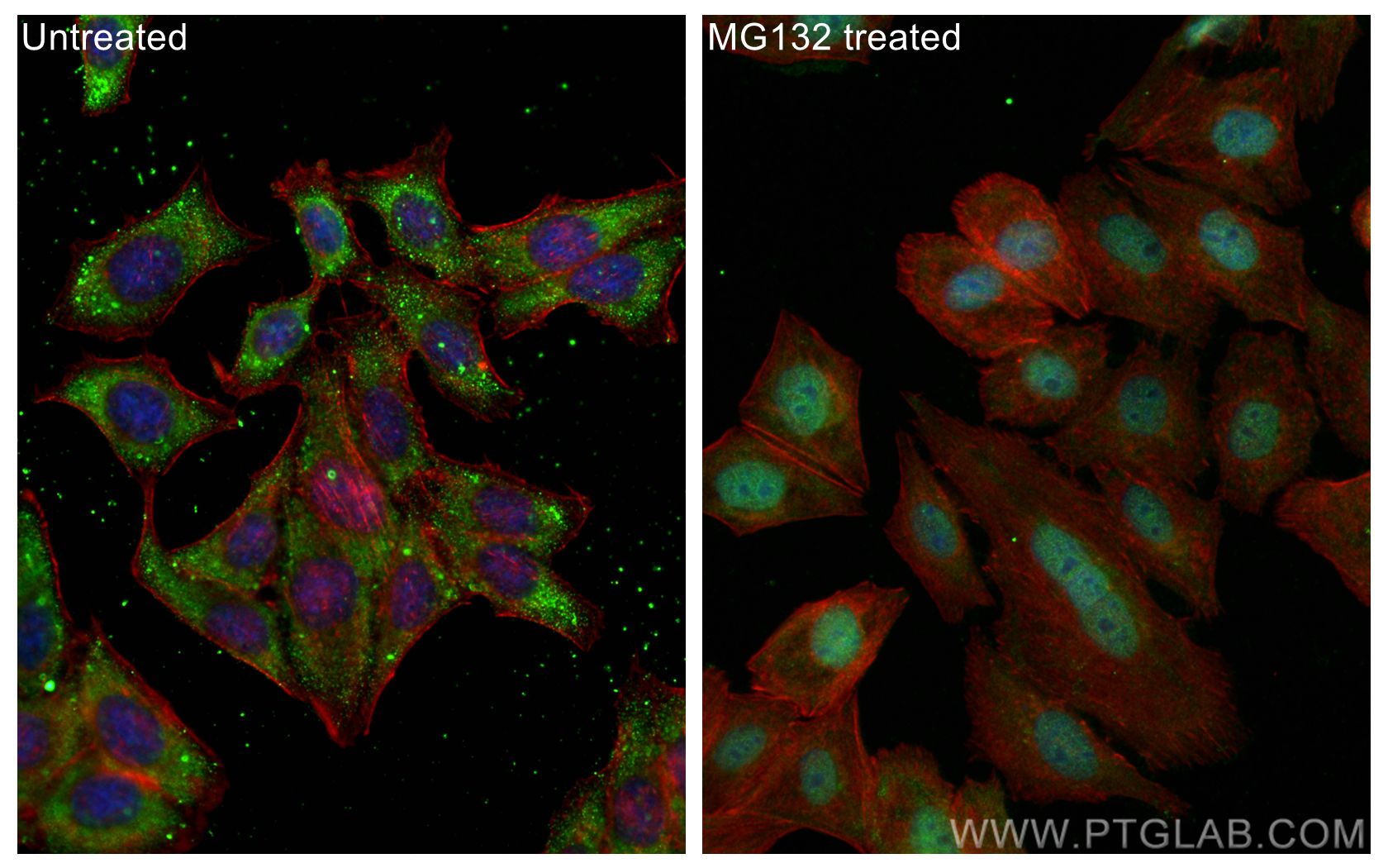 Immunofluorescence (IF) / fluorescent staining of HepG2 cells using NRF2, NFE2L2 Recombinant antibody (80593-1-RR)