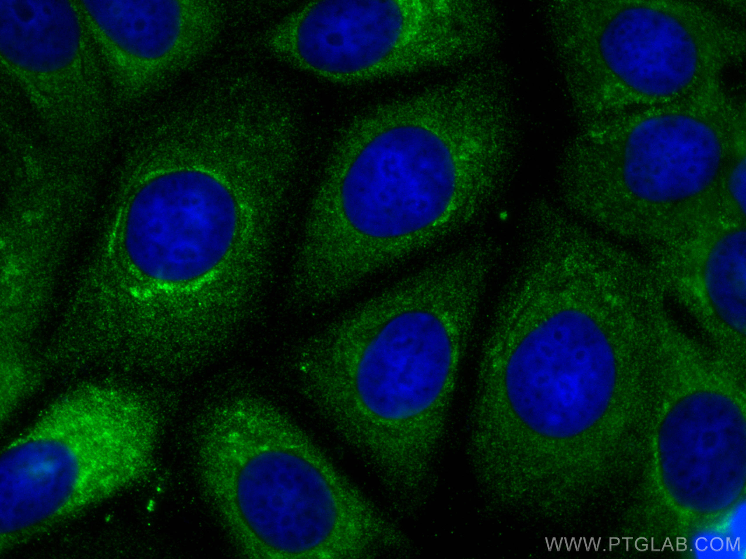 Immunofluorescence (IF) / fluorescent staining of MCF-7 cells using NRG1, isoform SMDF Polyclonal antibody (10527-1-AP)