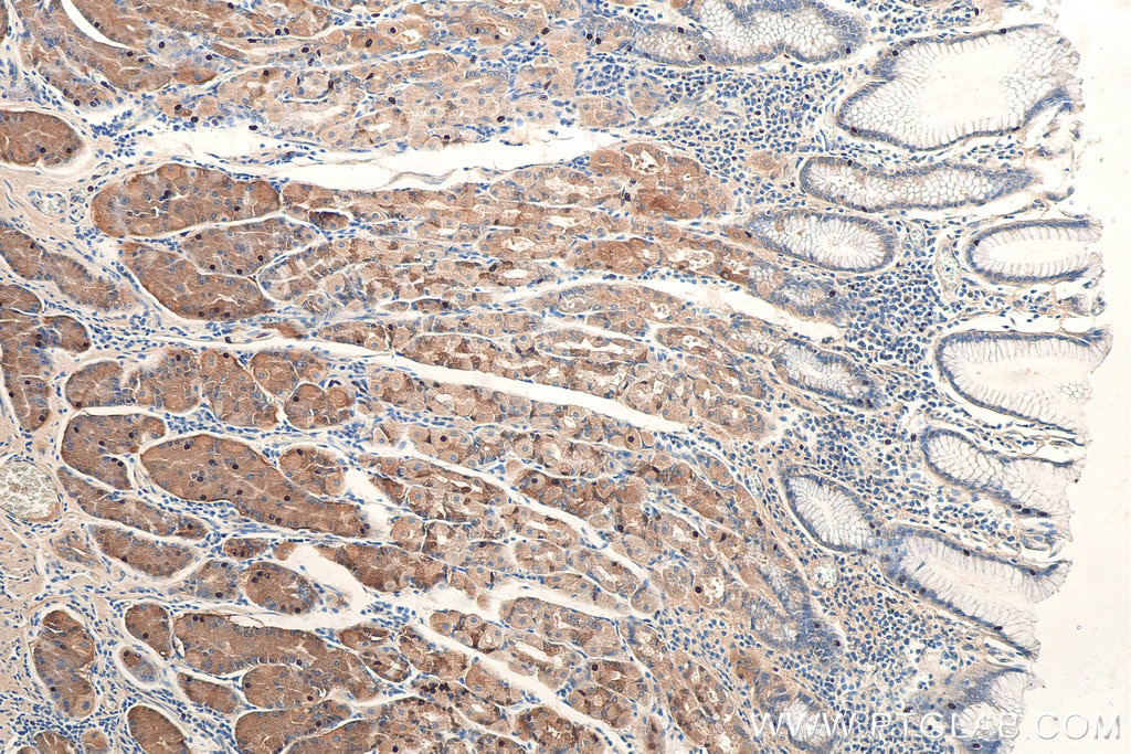 Immunohistochemistry (IHC) staining of human stomach tissue using NRG1, isoform SMDF Polyclonal antibody (10527-1-AP)