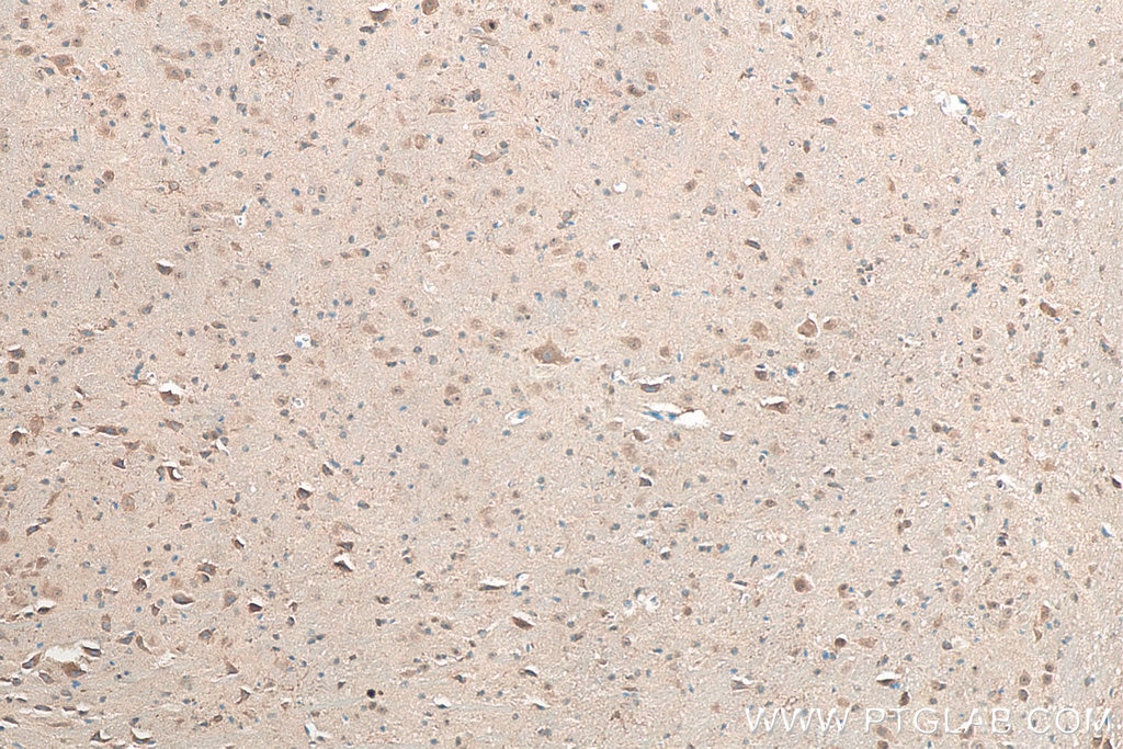 IHC staining of mouse cerebellum using 10527-1-AP