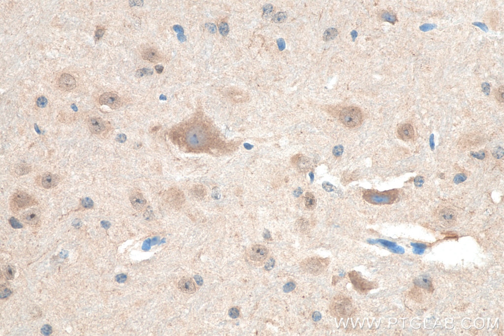 Immunohistochemistry (IHC) staining of mouse cerebellum tissue using NRG1 Polyclonal antibody (10527-1-AP)