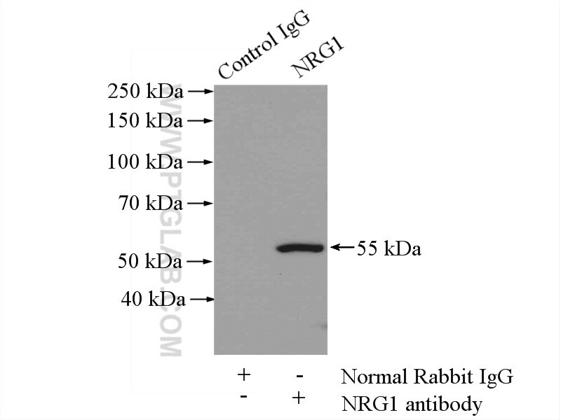 Immunoprecipitation (IP) experiment of mouse liver tissue using NRG1, isoform SMDF Polyclonal antibody (10527-1-AP)