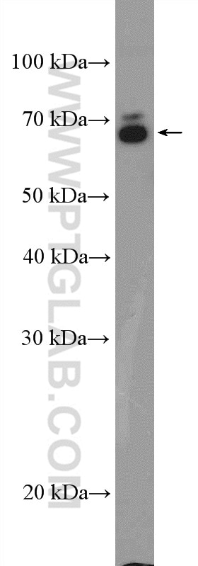 Western Blot (WB) analysis of SH-SY5Y cells using NRG1, isoform SMDF Polyclonal antibody (10527-1-AP)