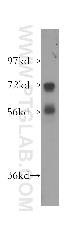 Western Blot (WB) analysis of human liver tissue using NRG1, isoform SMDF Polyclonal antibody (10527-1-AP)