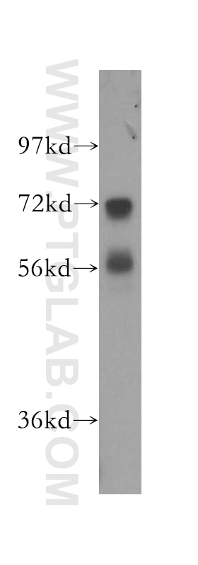 NRG1, isoform SMDF Polyclonal antibody