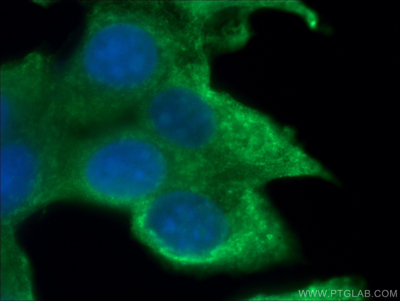 NRG1, isoform SMDF