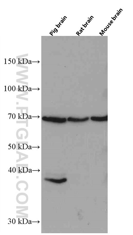 Western Blot (WB) analysis of pig brain tissue using NRG1 Monoclonal antibody (66492-1-Ig)