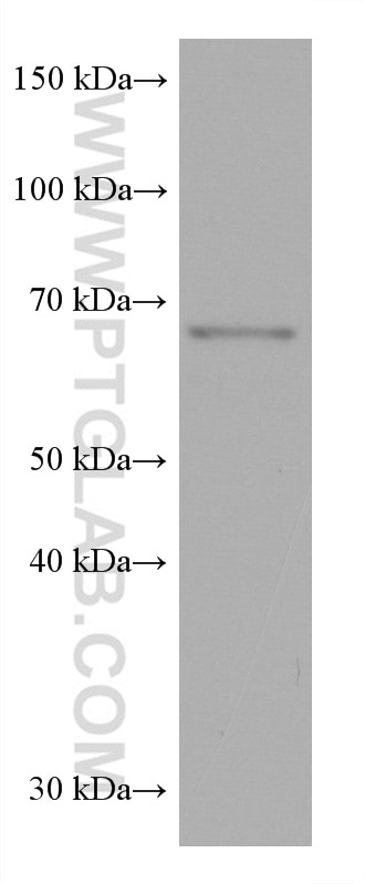 Western Blot (WB) analysis of rat cerebellum tissue using NRG1, isoform SMDF Monoclonal antibody (66492-1-Ig)