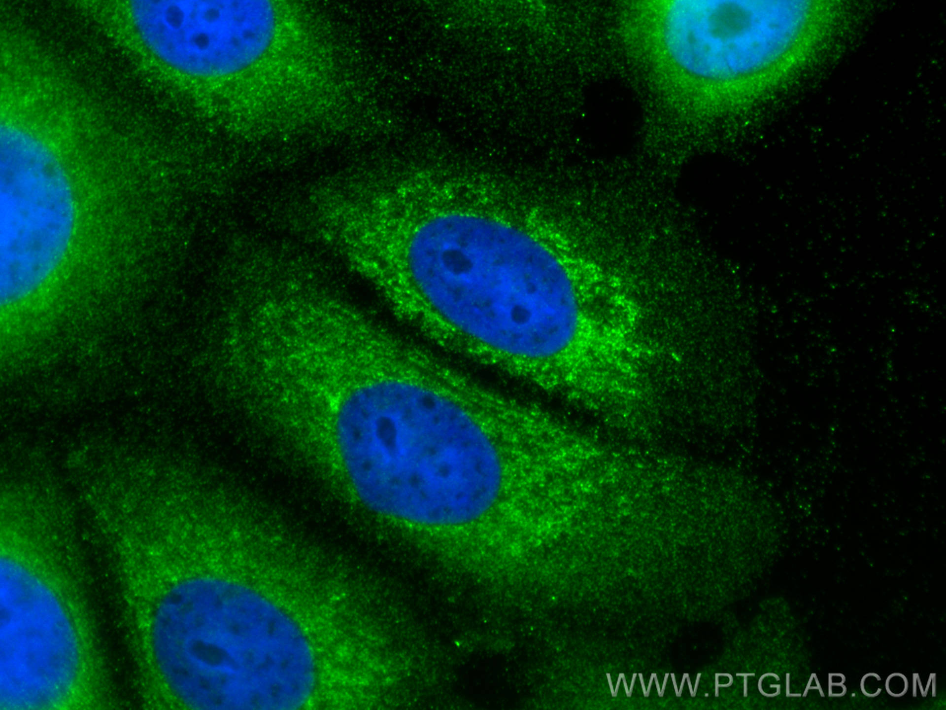 Immunofluorescence (IF) / fluorescent staining of MCF-7 cells using NRG1, isoform Alpha Polyclonal antibody (31043-1-AP)
