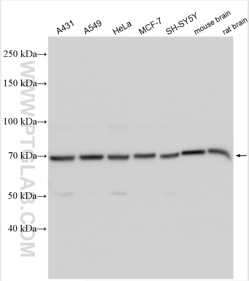 Western Blot (WB) analysis of various lysates using NRG1, isoform Alpha Polyclonal antibody (31043-1-AP)