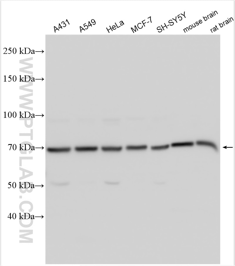 WB analysis using 31043-1-AP