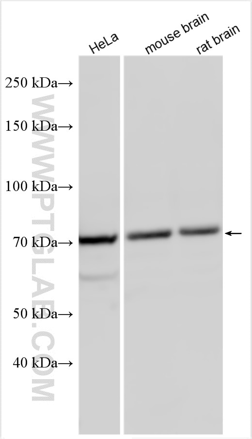 Western Blot (WB) analysis of various lysates using NRG1, isoform Beta1 Polyclonal antibody (31147-1-AP)