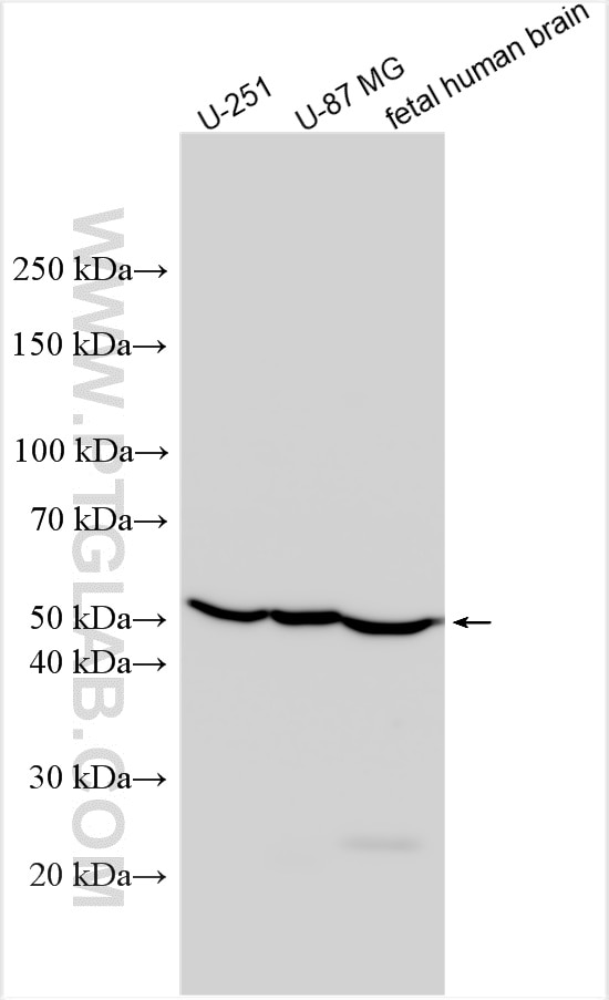 Western Blot (WB) analysis of various lysates using NRG2 Polyclonal antibody (20690-1-AP)