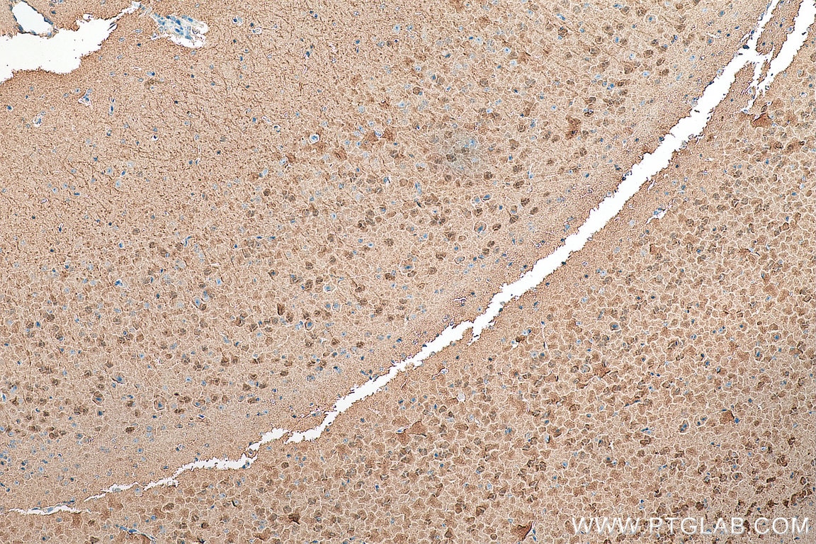 Immunohistochemistry (IHC) staining of mouse brain tissue using Neurogranin Polyclonal antibody (10440-1-AP)