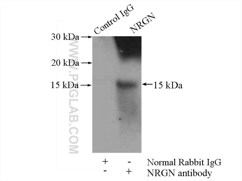 IP experiment of mouse brain using 10440-1-AP