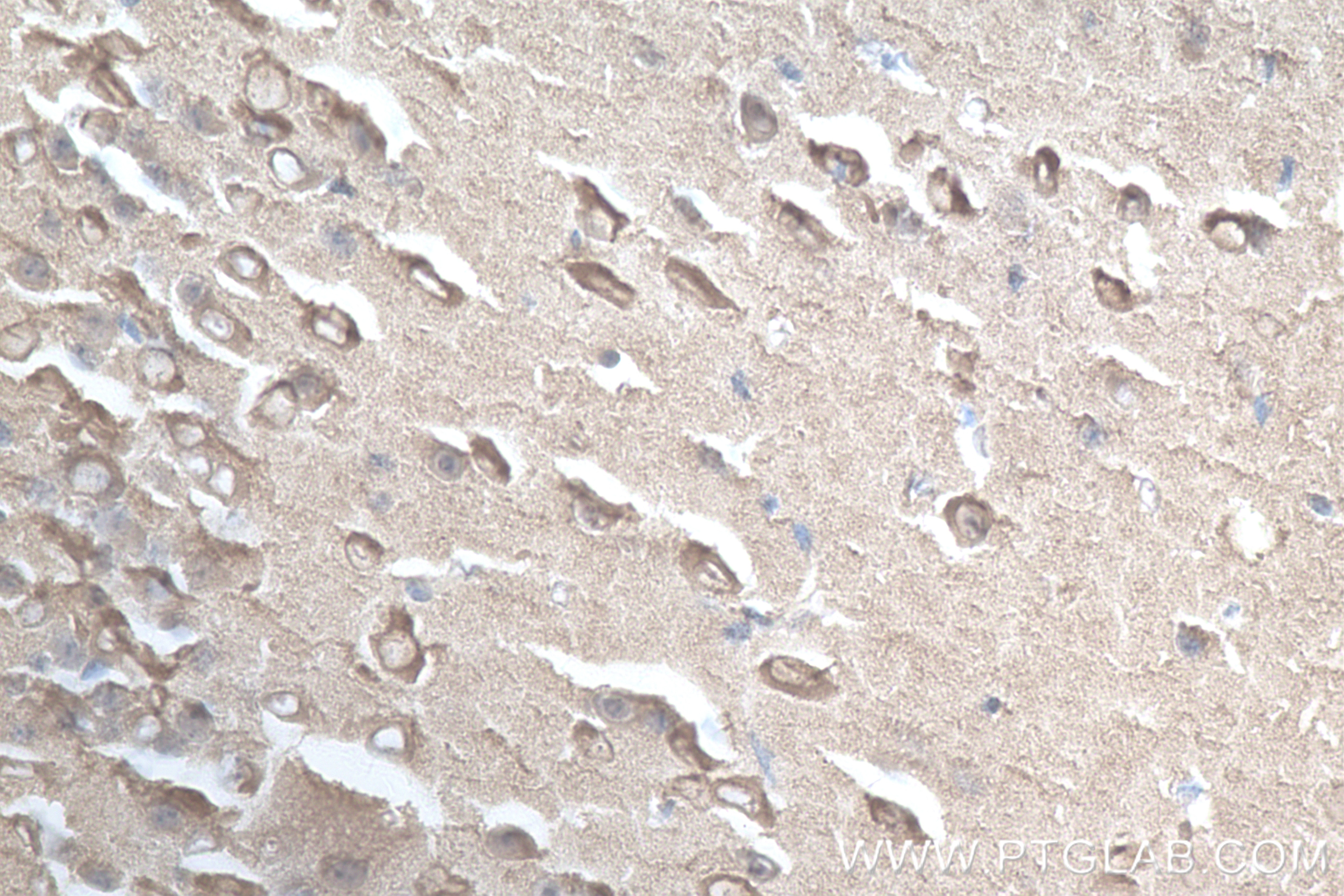Immunohistochemistry (IHC) staining of mouse brain tissue using Neurogranin Recombinant antibody (83593-5-RR)