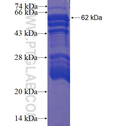 NRIP1 fusion protein Ag3940 SDS-PAGE